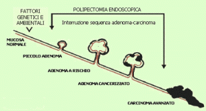 Formazione ed evoluzione dei polipi adenomatosi